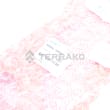 BRACKET, RH product photo image_2 S